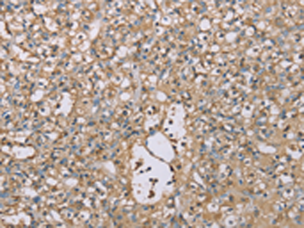 Rabbit Polyclonal Antibody to SCN1B