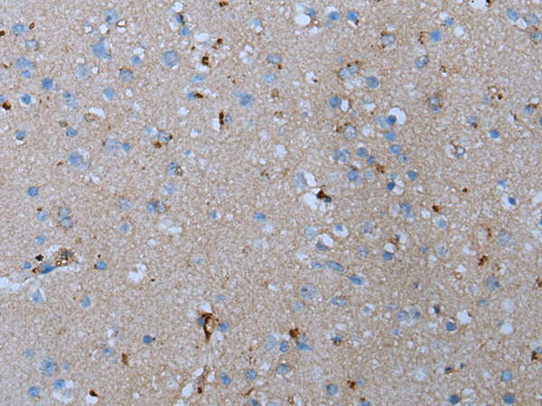 Rabbit Polyclonal Antibody to ADORA2B