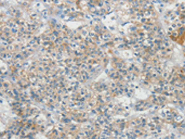 Rabbit Polyclonal Antibody to SCN9A