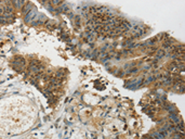 Rabbit Polyclonal Antibody to SYCP1