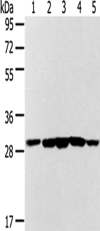 Rabbit Polyclonal Antibody to SDHB