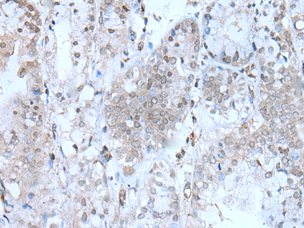 Rabbit Polyclonal Antibody to SERTAD1