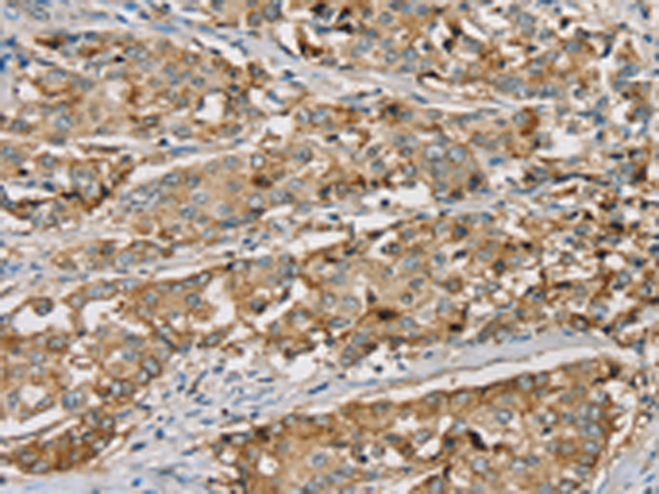 Rabbit Polyclonal Antibody to SEMA6A