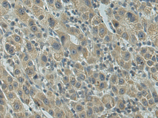 Rabbit Polyclonal Antibody to SEMA6D