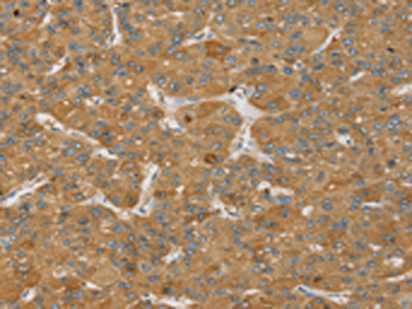 Rabbit Polyclonal Antibody to SENP3