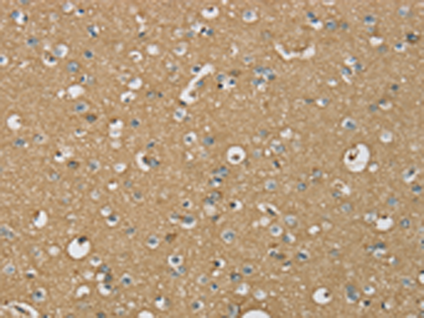 Rabbit Polyclonal Antibody to ATP2A3