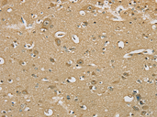 Rabbit Polyclonal Antibody to SERINC1