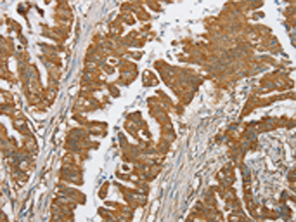 Rabbit Polyclonal Antibody to SERINC2