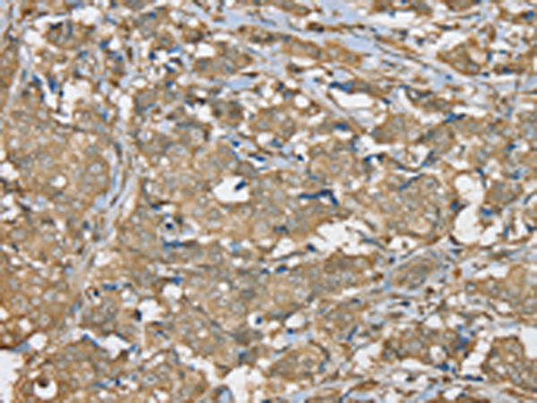 Rabbit Polyclonal Antibody to SERPINA11