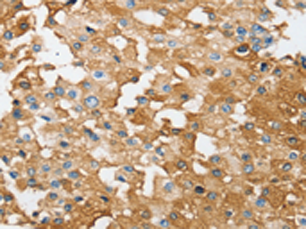 Rabbit Polyclonal Antibody to SESN2