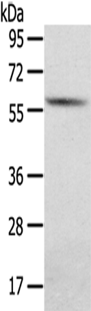 Rabbit Polyclonal Antibody to SGPL1