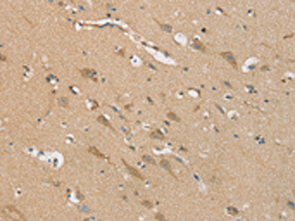 Rabbit Polyclonal Antibody to NES