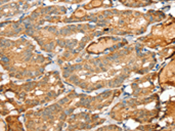Rabbit Polyclonal Antibody to SIGLEC14