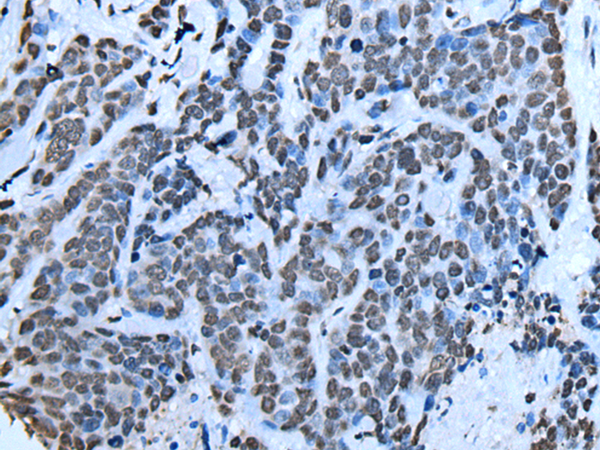 Rabbit Polyclonal Antibody to SIN3B