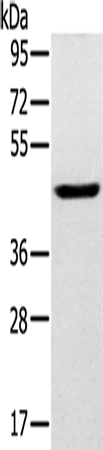 Rabbit Polyclonal Antibody to SLC16A8