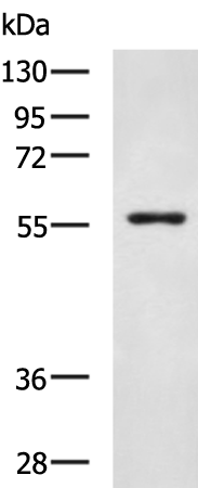 Rabbit Polyclonal Antibody to SLC16A10