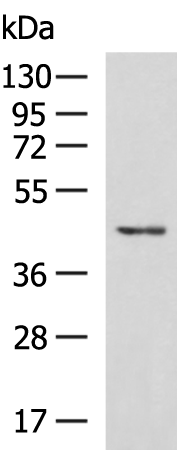 Rabbit Polyclonal Antibody to SLC16A11