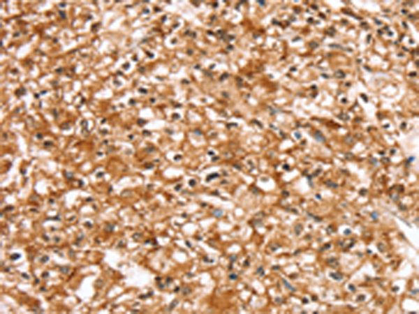 Rabbit Polyclonal Antibody to SLC16A12