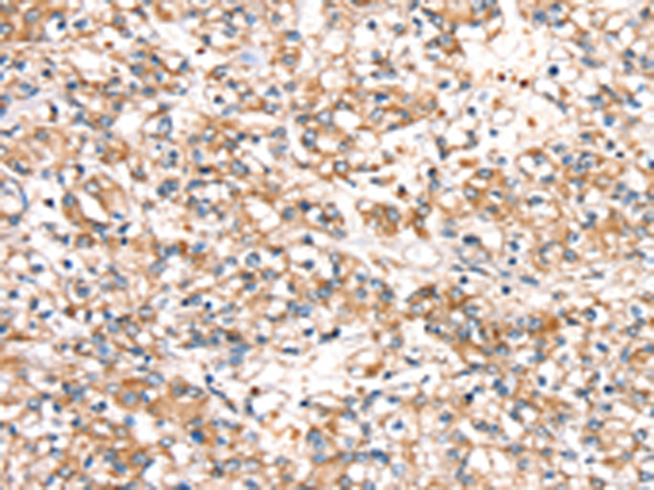 Rabbit Polyclonal Antibody to SLC24A3