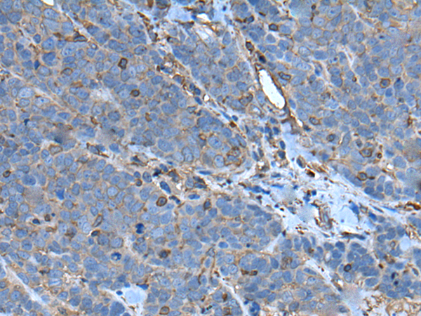 Rabbit Polyclonal Antibody to SLC24A5