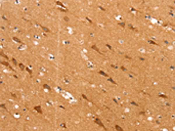 Rabbit Polyclonal Antibody to SLC25A12