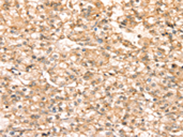 Rabbit Polyclonal Antibody to SLC25A38