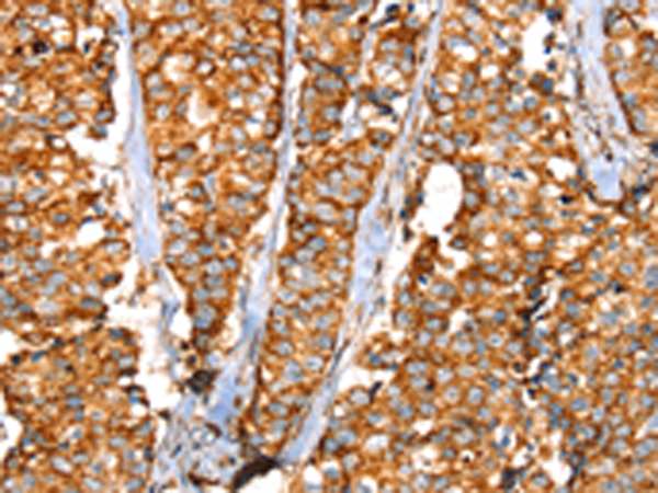 Rabbit Polyclonal Antibody to SLC25A3