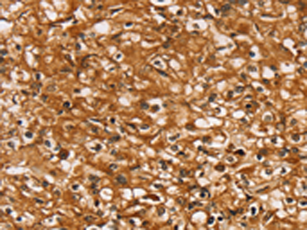Rabbit Polyclonal Antibody to SLC26A6