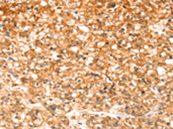 Rabbit Polyclonal Antibody to SLC32A1