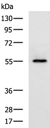 Rabbit Polyclonal Antibody to SLC39A5