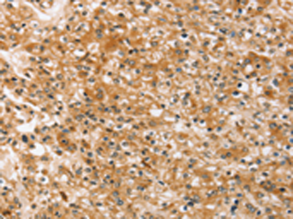 Rabbit Polyclonal Antibody to SLC40A1