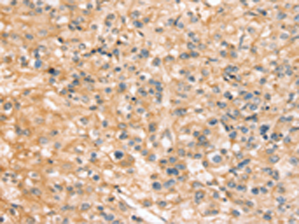 Rabbit Polyclonal Antibody to SLC44A1