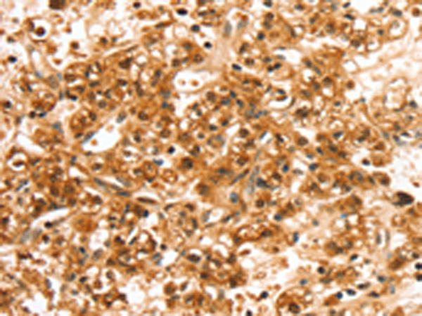 Rabbit Polyclonal Antibody to SLC44A2