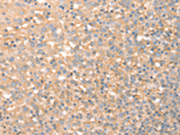 Rabbit Polyclonal Antibody to SLC4A7