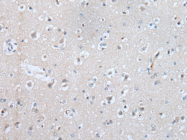 Rabbit Polyclonal Antibody to SLC5A10