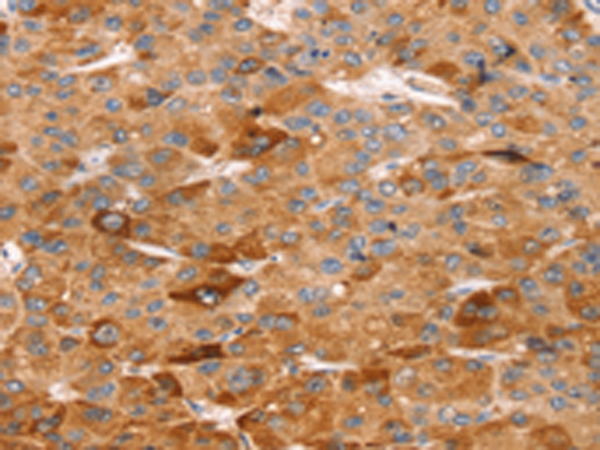 Rabbit Polyclonal Antibody to SLC5A11