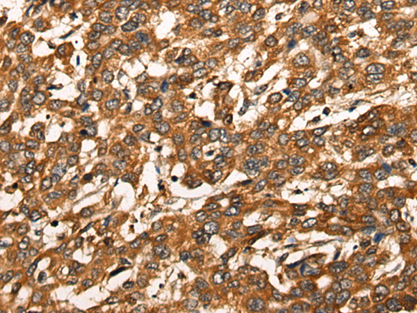 Rabbit Polyclonal Antibody to SLC5A3