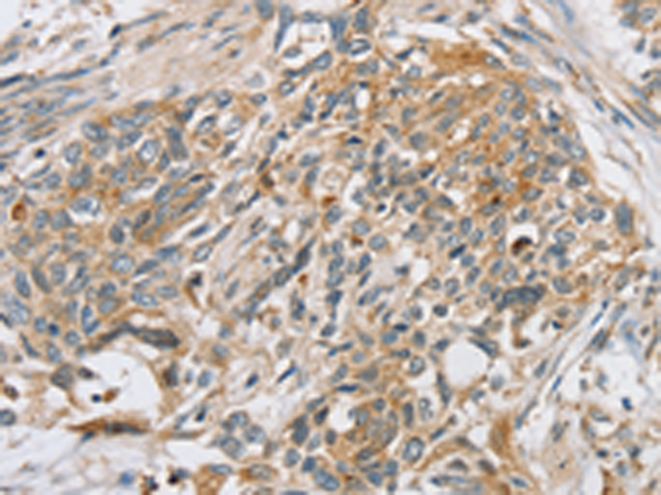 Rabbit Polyclonal Antibody to SLC5A6