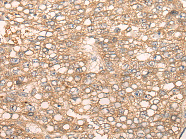 Rabbit Polyclonal Antibody to SLC5A8