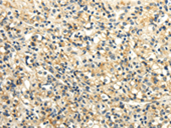 Rabbit Polyclonal Antibody to SLC6A19