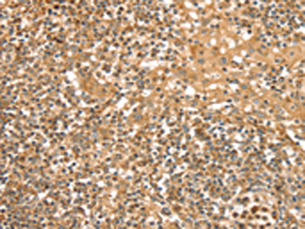 Rabbit Polyclonal Antibody to SLC8A3