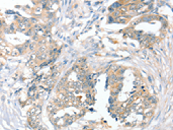 Rabbit Polyclonal Antibody to SLC9A9