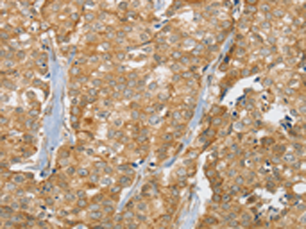Rabbit Polyclonal Antibody to SLC9A3R2