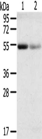 Rabbit Polyclonal Antibody to SLC17A1