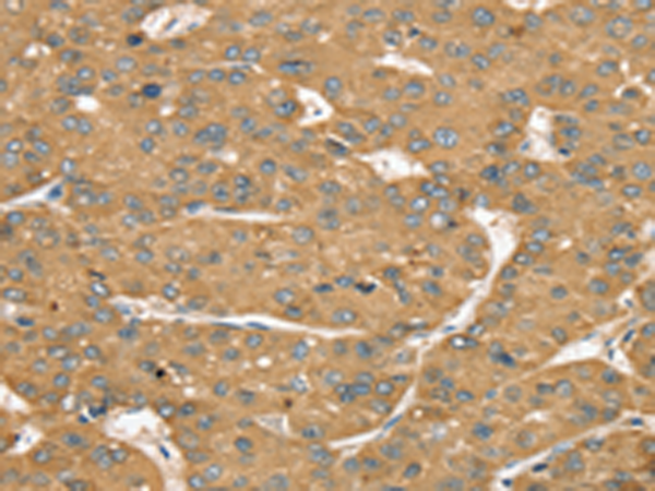 Rabbit Polyclonal Antibody to SLIT1