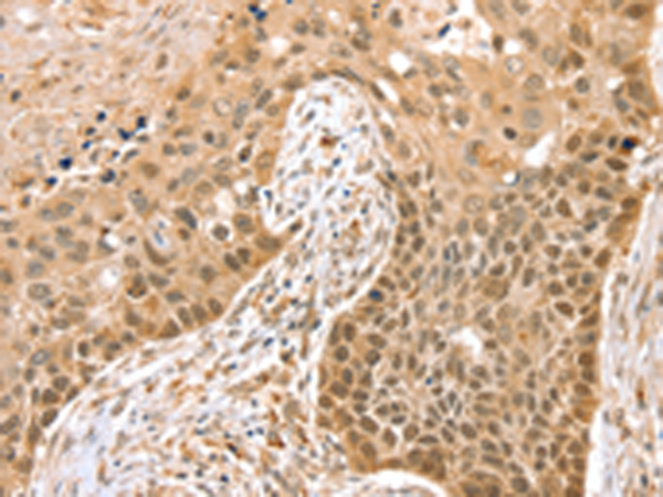 Rabbit Polyclonal Antibody to SMARCA2