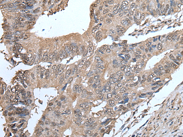 Rabbit Polyclonal Antibody to SMC5