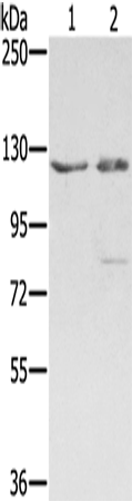 Rabbit Polyclonal Antibody to SMC6