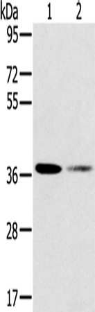 Rabbit Polyclonal Antibody to SMN1