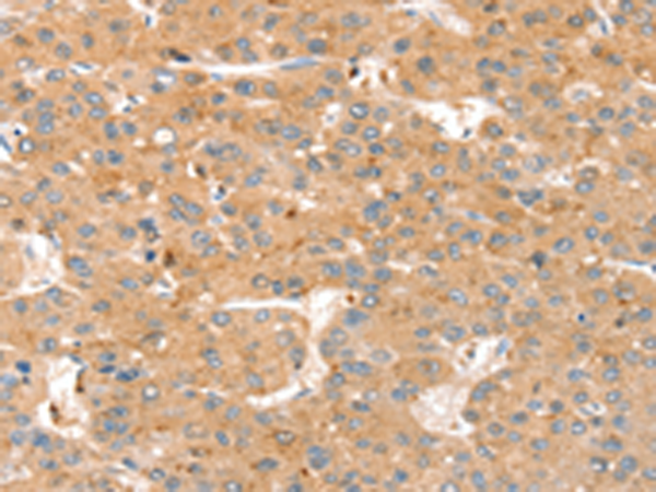 Rabbit Polyclonal Antibody to SMOC2